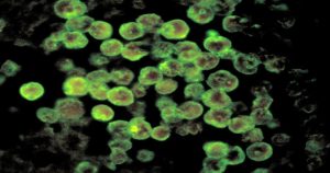 العدوى الآكلة للدماغ مجهريا