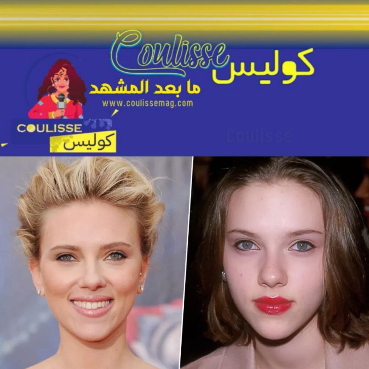 هل الشفاه المحقونة أم الطبيعية جميلة وأي نوع يفضله الرجال