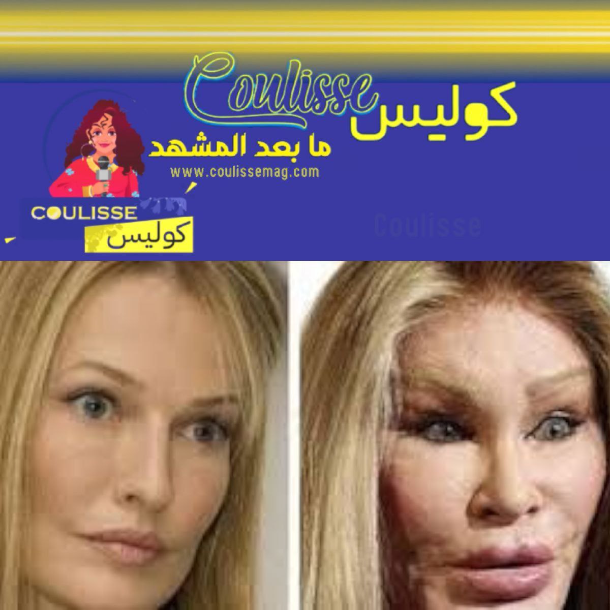 عمليات التجميل ومتى يتحول السعي للجمال إلى خطر على الحياة؟