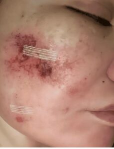 ياسمين الخطيب بين مشرط الجراحة وضغوط الشاشة… عدوى مفاجئة توقف برنامجها وتفتح نقاشًا أوسع