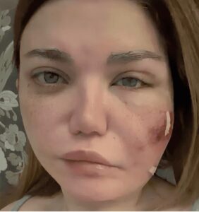 ياسمين الخطيب بين مشرط الجراحة وضغوط الشاشة… عدوى مفاجئة توقف برنامجها وتفتح نقاشًا أوسع